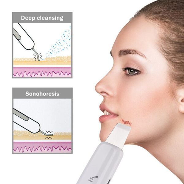 Ultrasonic Skin Scrubber Deep Cleaning 6